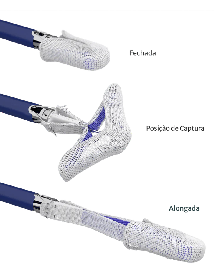 As três configurações do implante PASCAL durante o procedimento: fechada, em posição de captura e alongada